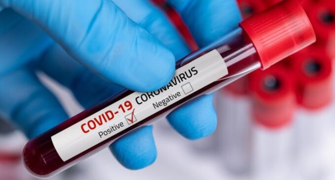 COVID-19: Nigeria records lowest daily infections in five month, no death